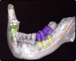 歯科用CT＆セファロレントゲンシステムの導入